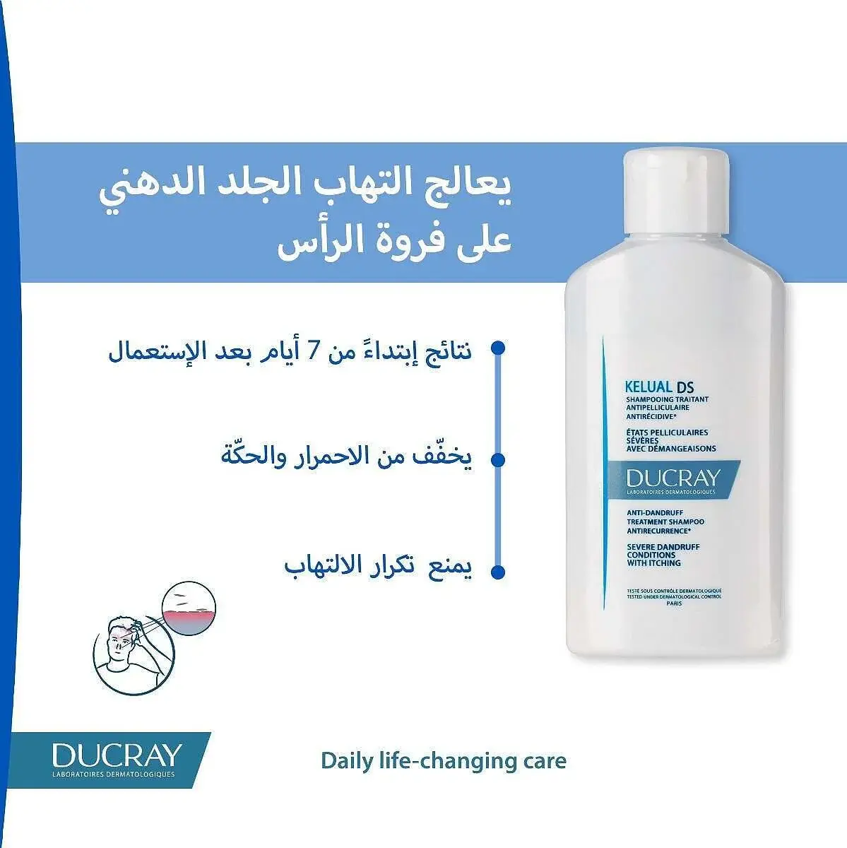 دوكراي كيلوال د س شامبو للحدّ من الإلتهاب الجلد الدهني، الشامبو الرائد في الأسواق لمكافحة القشرة - 100 مل - الصورة 4